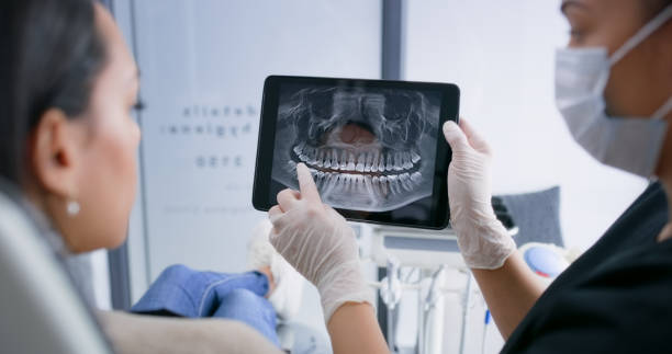 Licensed Tooth Extraction service in Belmont, CA - Smile Center Dentistry